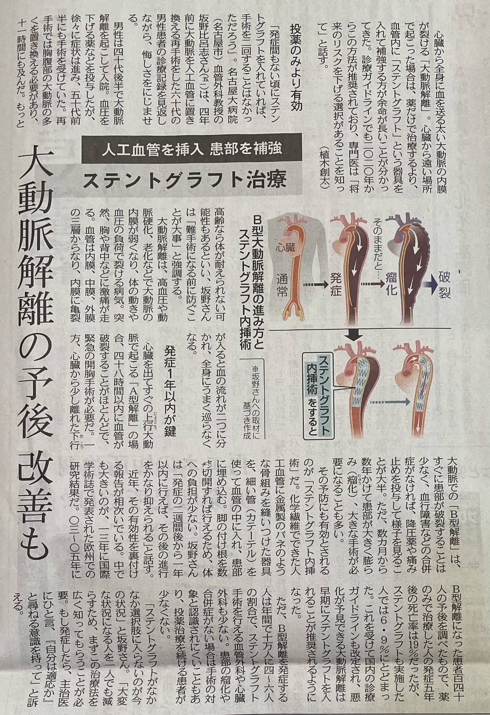 新聞記事